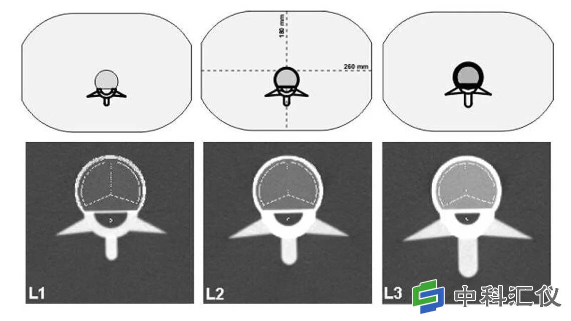 QRM-ESP 的 CT 图像。椎体中段扫描图像，并叠加了自动确定的松质骨和皮质骨 ROI。.png